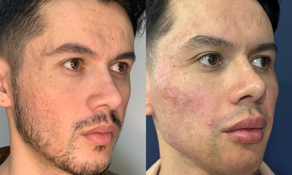 Medicina estetica, botox, acido hialuronico, dermatologia, dermatologo, medico estetico, belleza, cirugia plastica, tratamiento sin cirugia, rejuvenecimiento, bioestimuladores, cuidado de la piel